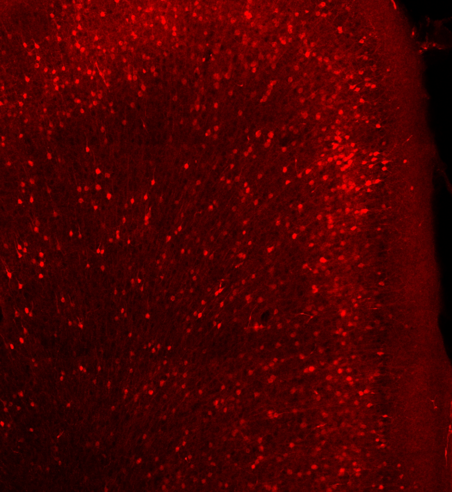 Red-labeled neurons across a cortical column