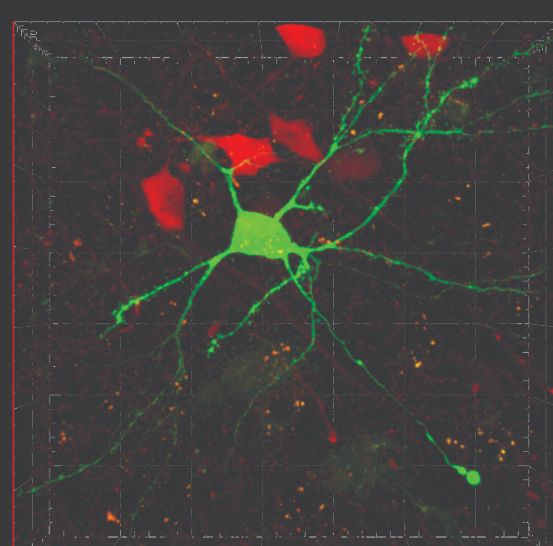 3D reconstruction of a dye-filled neuron among red-labeled cells