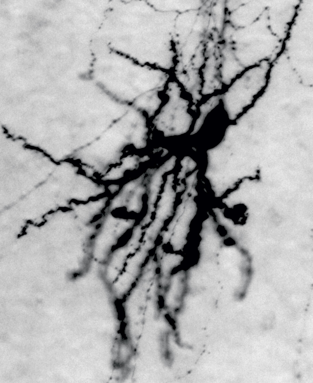 Black and white neuron microscopy