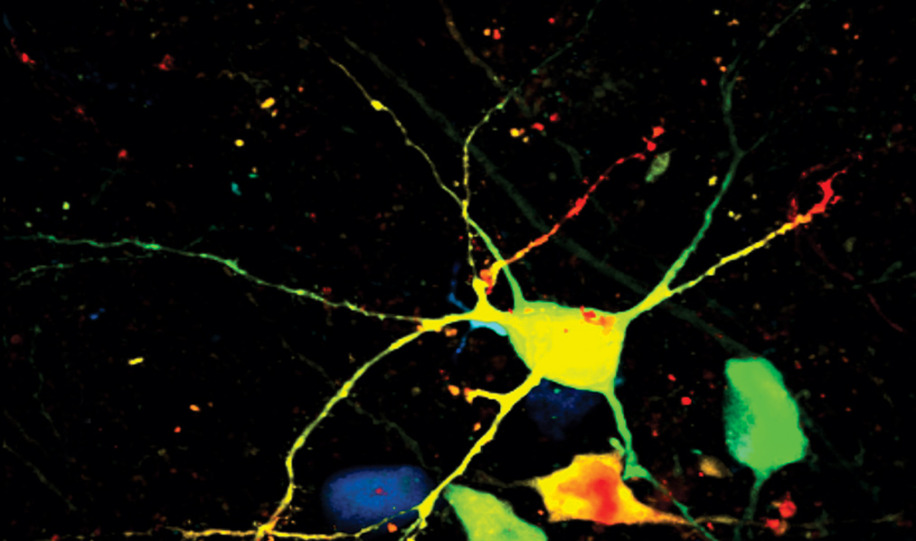 Neuron multicolor fluorescence microscopy