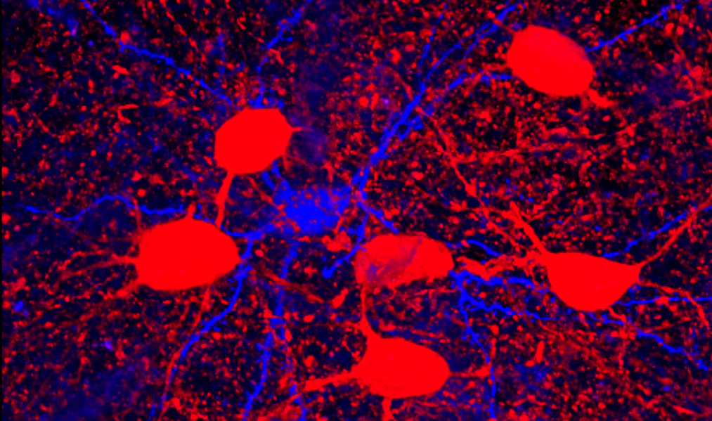 Red channel neuron fluorescence