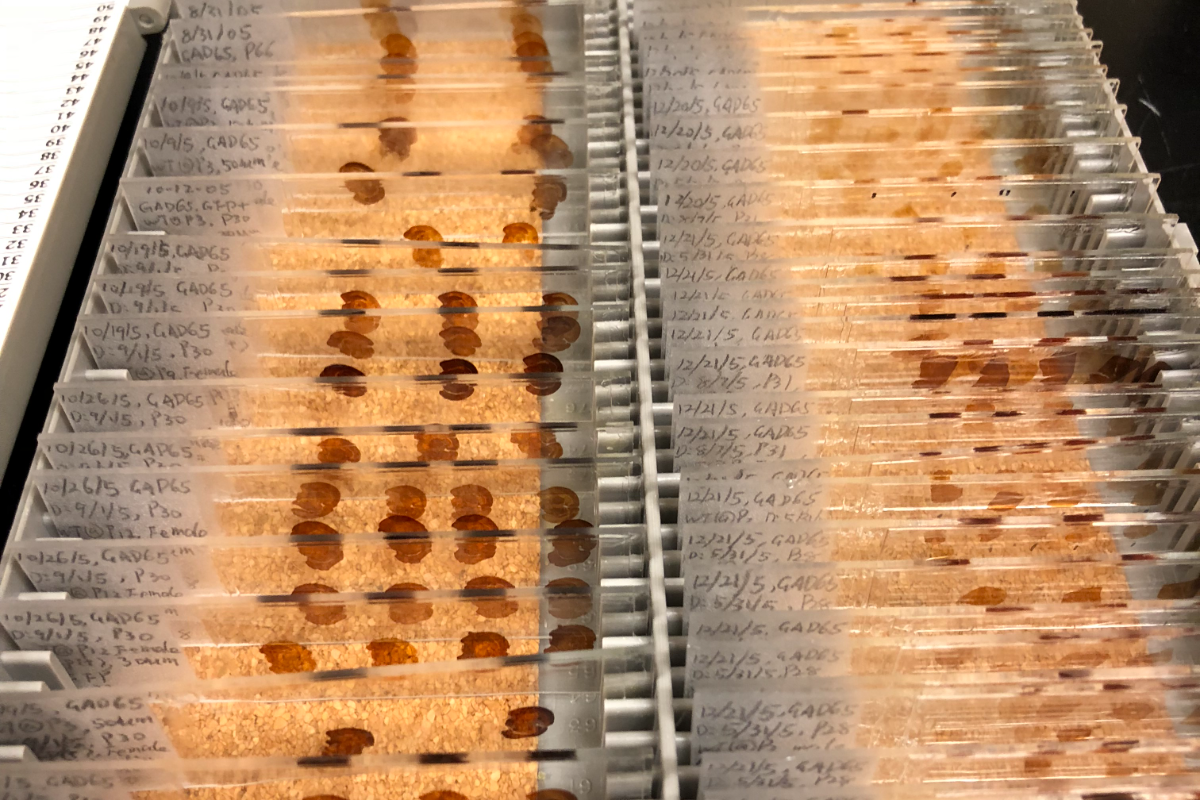 Archived immunohistochemistry slides in a storage tray